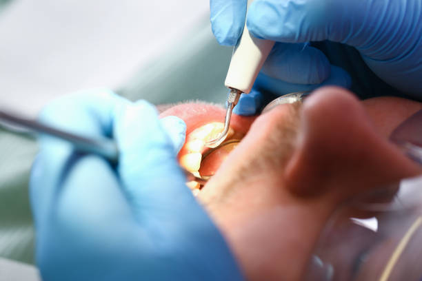 Best Emergency Dental Extractions in Norwood, PA